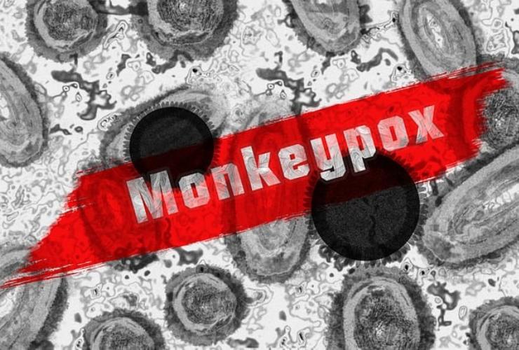 Monkeypox